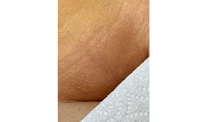 BRAZILIAN WAXING